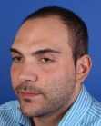 Before Hair Transplant&nbsp;Front